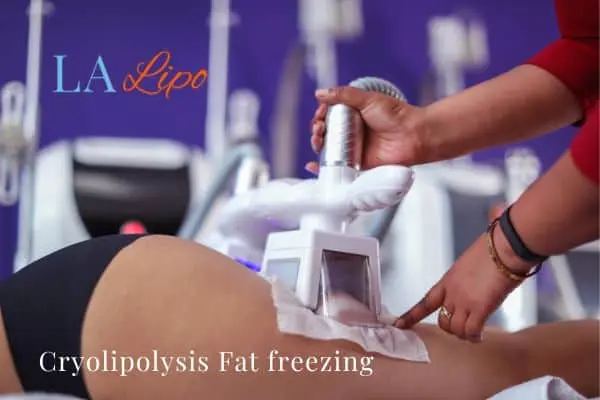 women getting fat freezing Malvern Wells