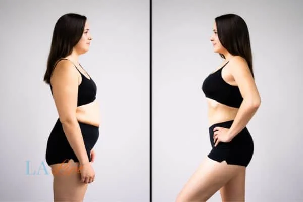 link between body image and mental health Malvern Wells