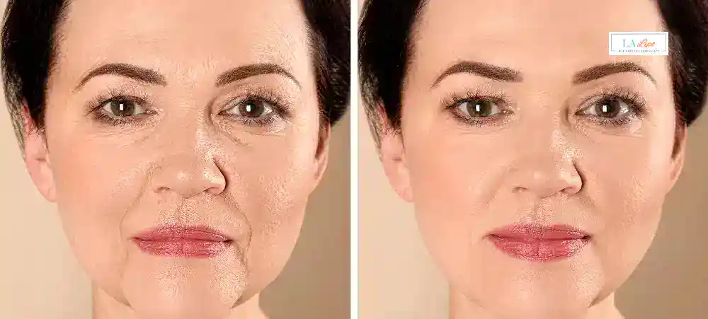 Why Aren’t My Skincare Products Making My Sagging Skin Look Firmer Malvern Wells?