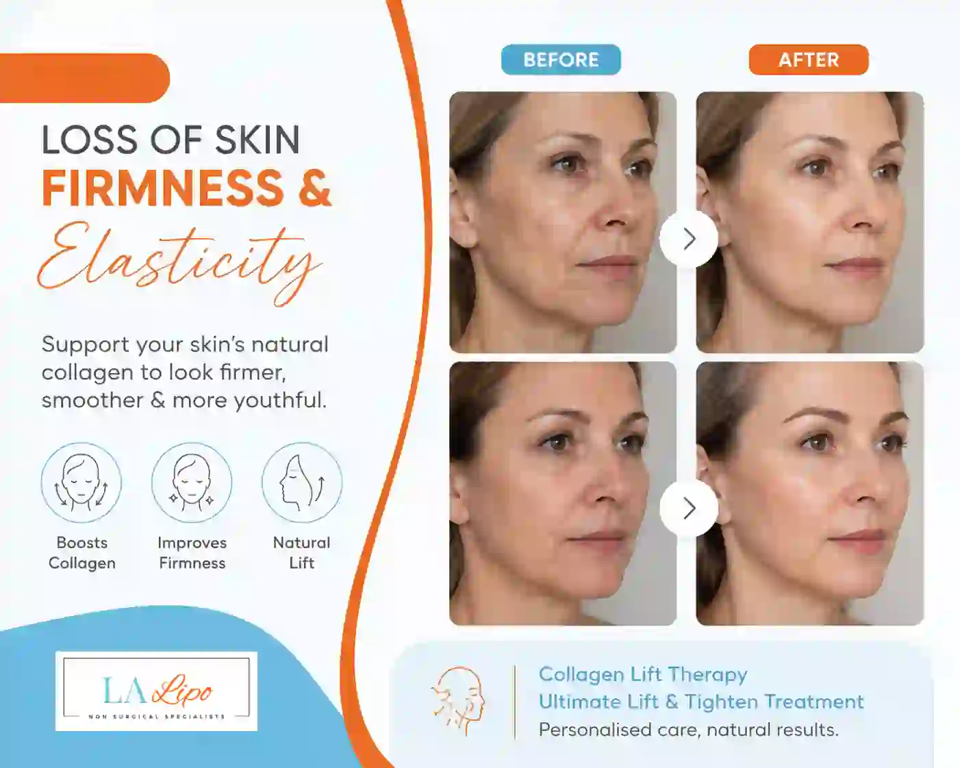 Sign #7: Loss of Skin Firmness and Elasticity Malvern Wells